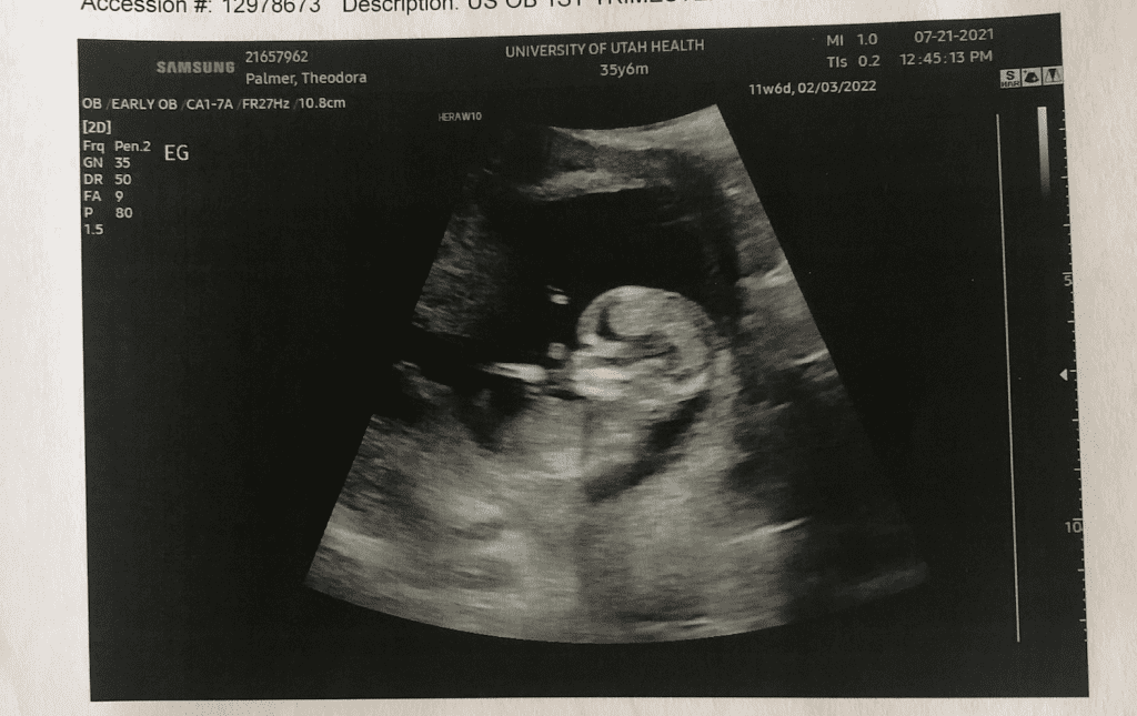 12 week ultrasound photo July 2021